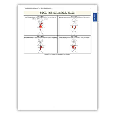 Page 7: CK7 and CK20 Expression Profile Diagram