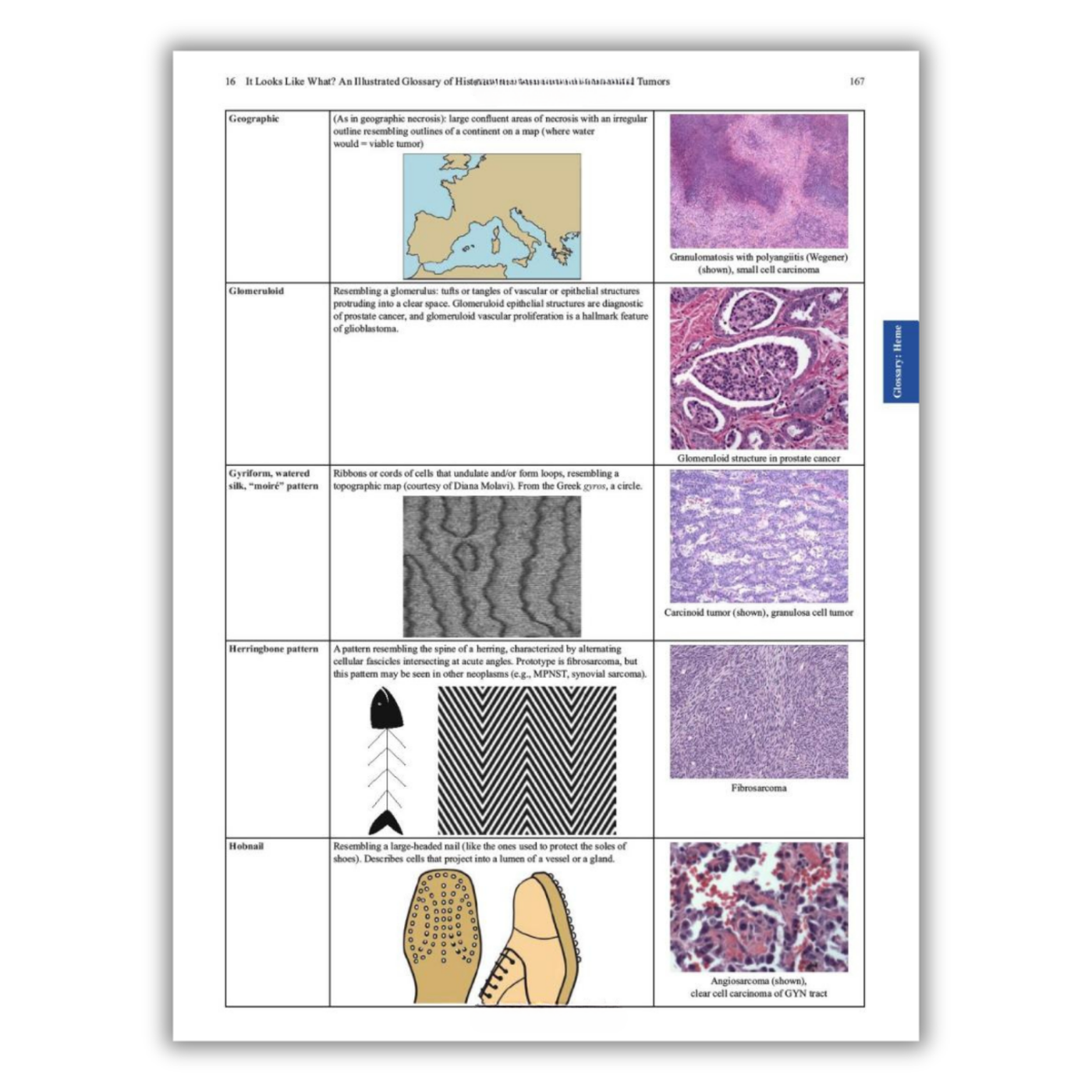 Page 16: Section showing different kinds of tumors and what they look like