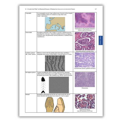 Page 16: Section showing different kinds of tumors and what they look like